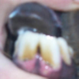 Dental Bite 2012