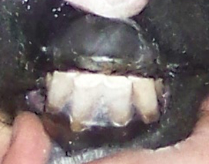 Perfect Teeth Alignment!